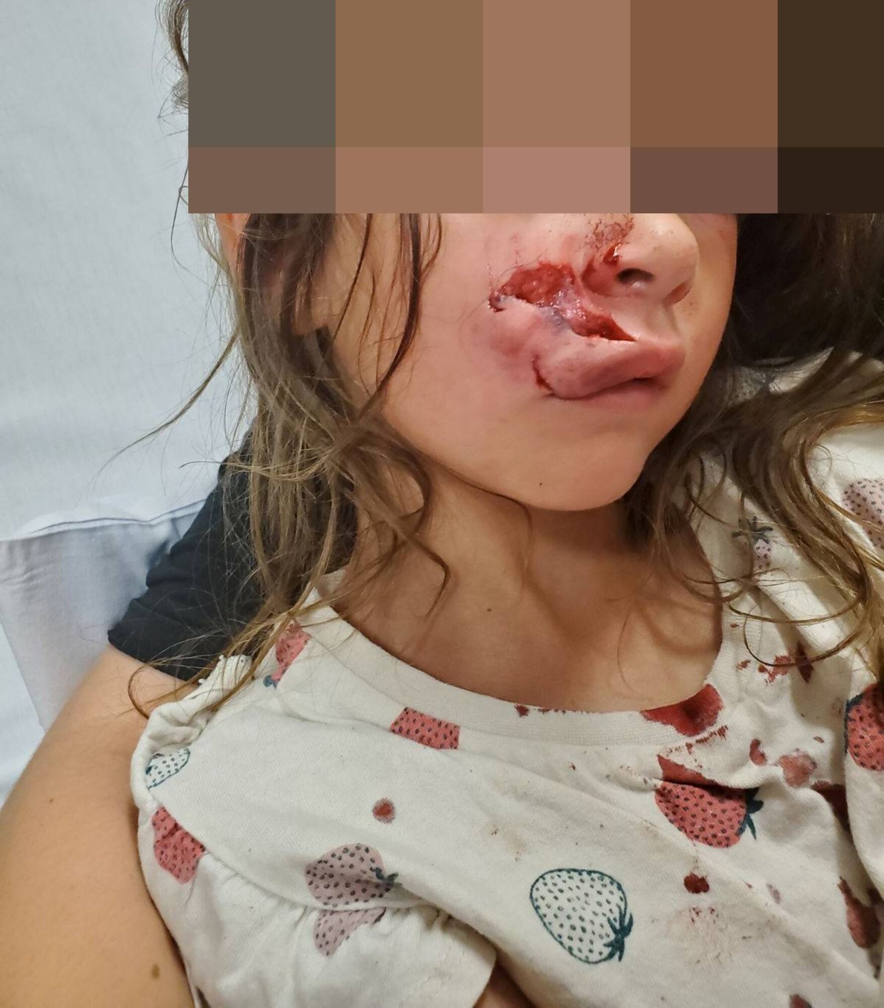  The 6-year-old was bitten by Tank, her uncle&rsquo;s nine-year-old American bulldog cross, on Christmas Eve.  Photo / Supplied