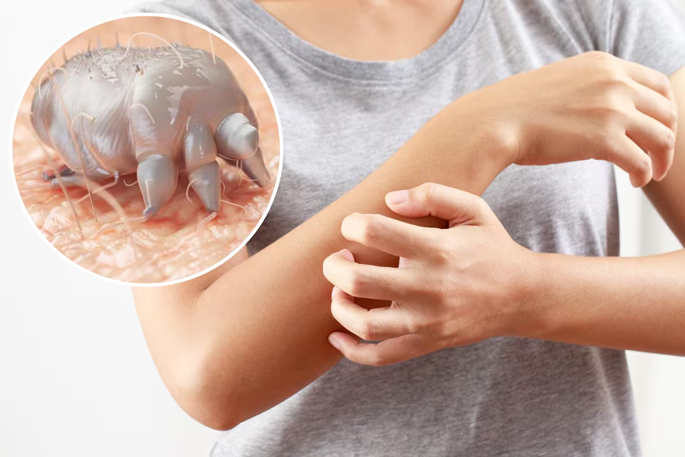 SunLive - Six months, four doctors before scabies found - The Bay's News First