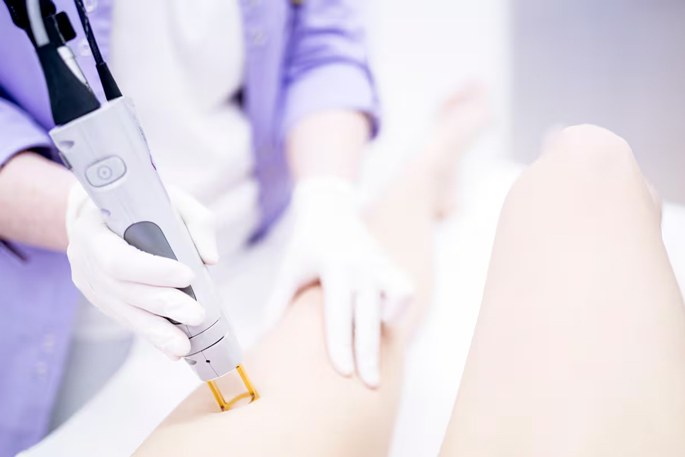 Woman left with leg burns after laser treatment