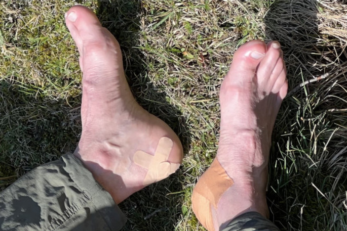 What is Hiker's Wool? - Waikato Podiatry